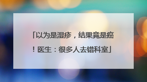 以为是湿疹，结果竟是癌！医生：很多人去错科室